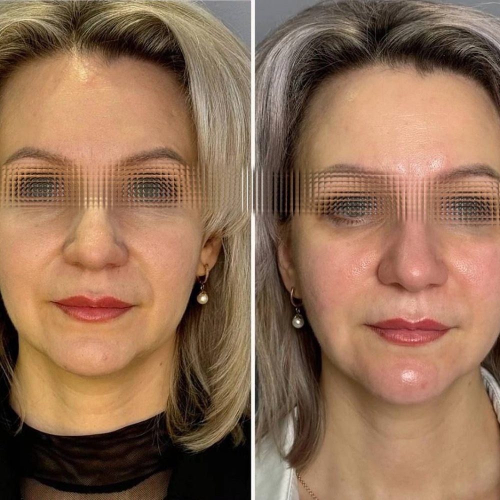 WhatsApp Image 2025-04-23 at 14.20.43_3b751b12